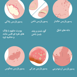 آیا پسوریازیس از پدر به فرزند منتقل میشود + پسوریازیس ارثی است؟
