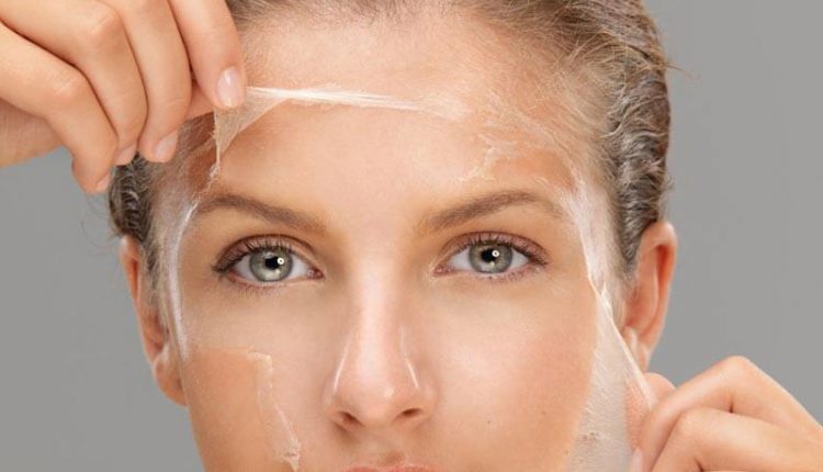 لایه برداری پوست صورت