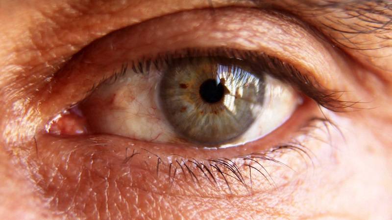 روزاسه چشمی