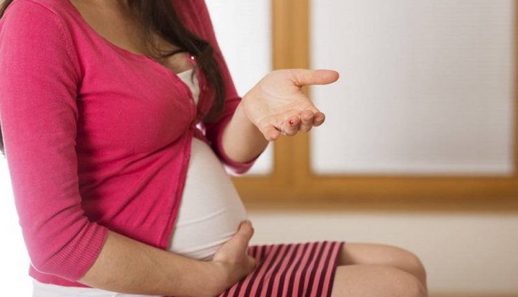 سوزاندن زگیل تناسلی در بارداری