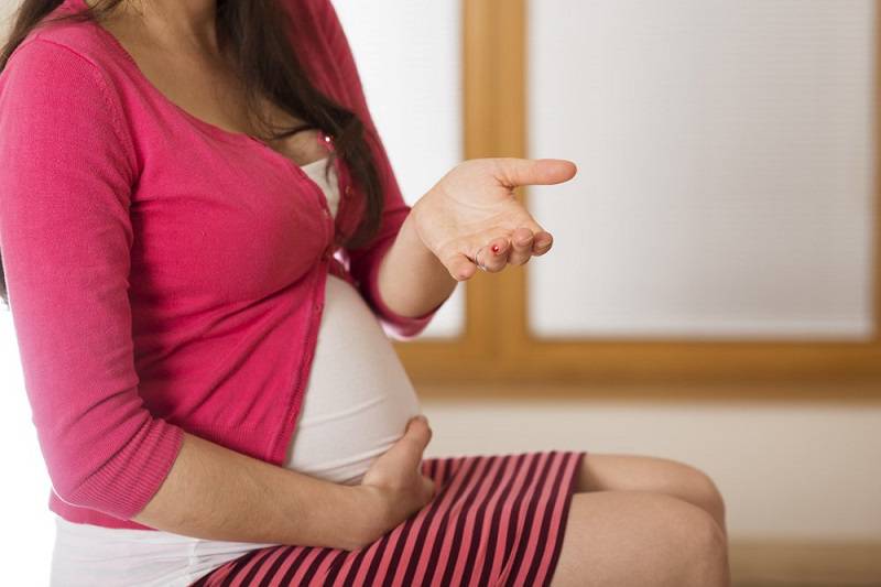 سوزاندن زگیل تناسلی در بارداری