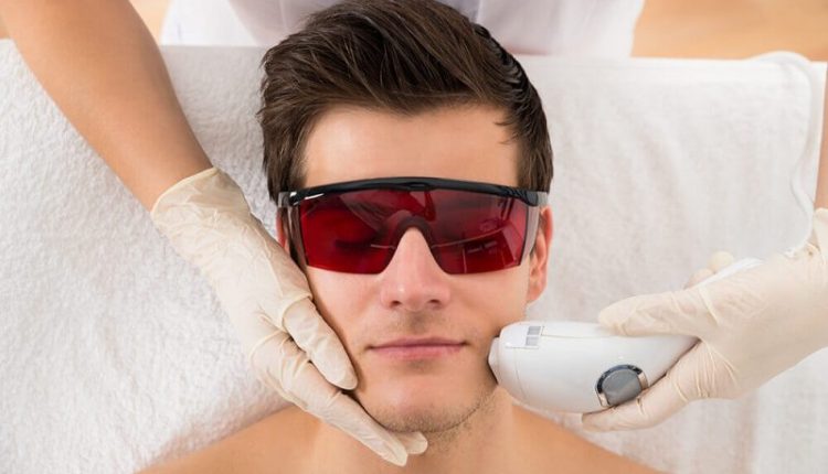 لیزر موهای زائد صورت مردان