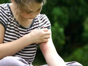 خارش پوست در بهار