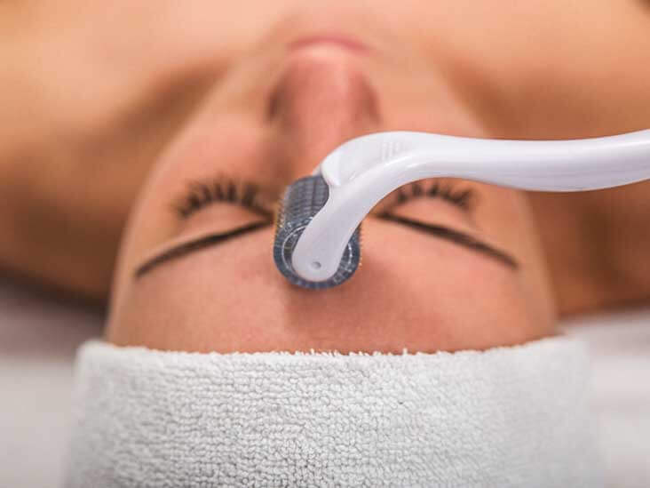 خطرات و عوارض میکرونیدلینگ صورت