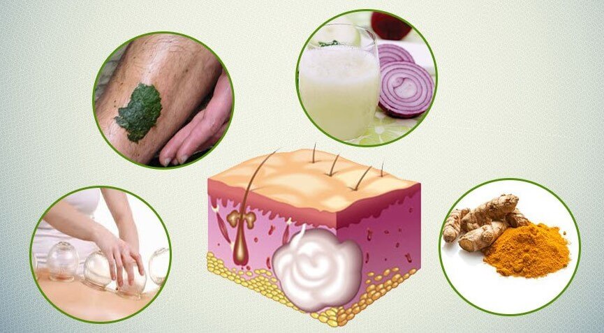 درمان خانگی جوش صورت