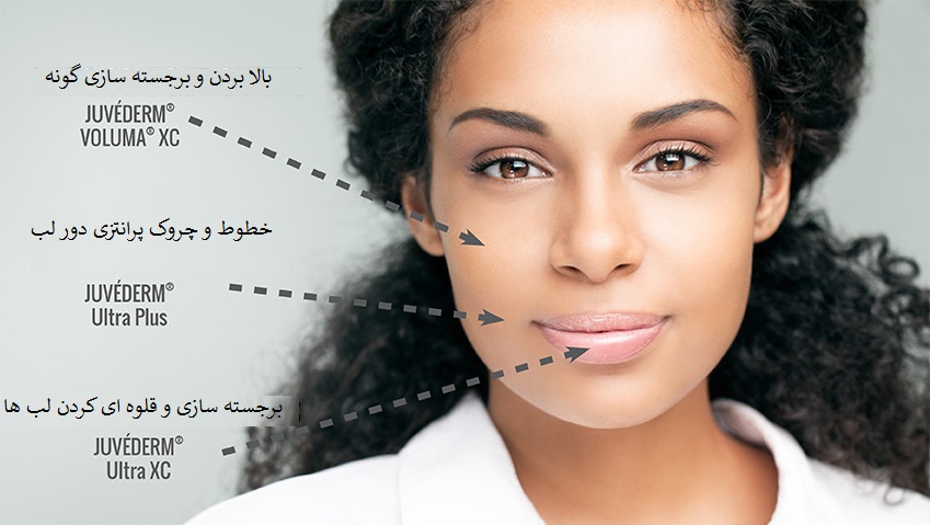 بهترین ژل برای رفع خط خنده