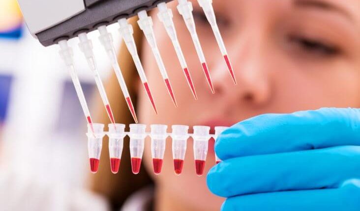 پیوند مو با سلول های بنیادی