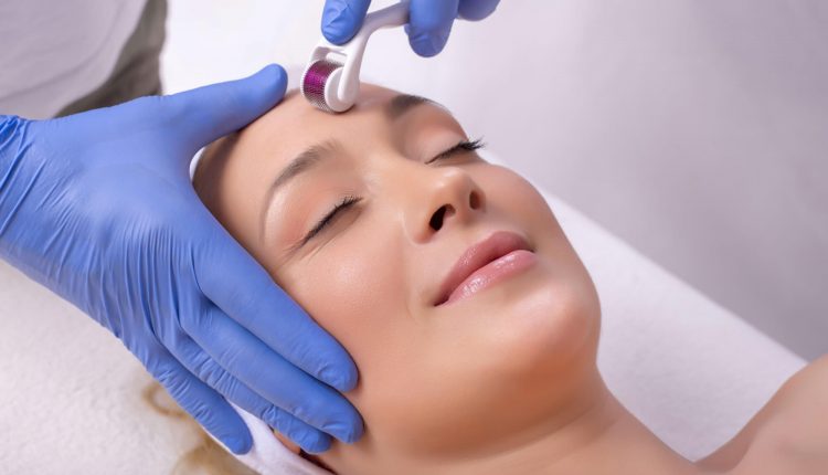 مراقبت های بعد از میکرونیدلینگ