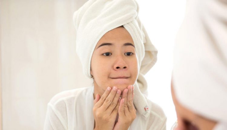 علائم جوش هورمونی