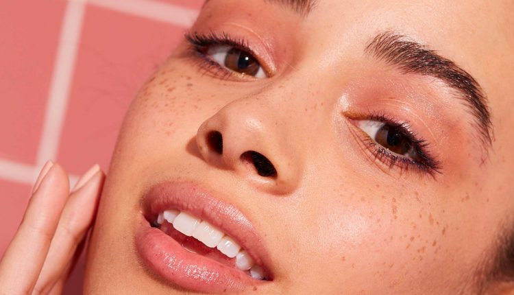 درمان کک و مک صورت با لیزر