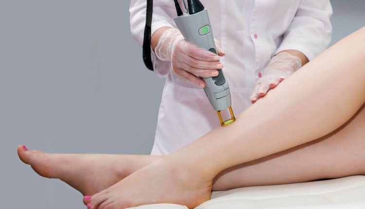 نکاتی که باید قبل از لیزر موهای بدن و پا رعایت کرد