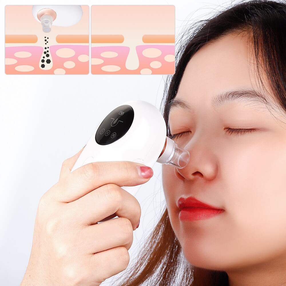 کاهش منافذ روی پوست بینی با میکرودرم ابریژن