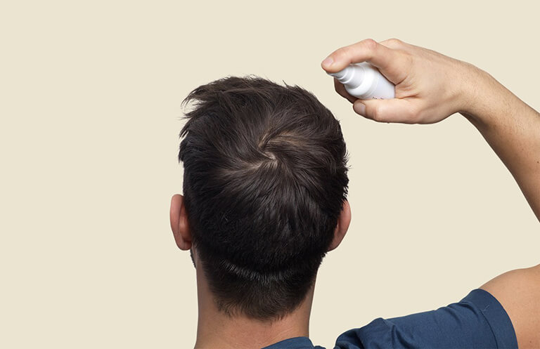 عوامل مؤثر بر ریزش مو