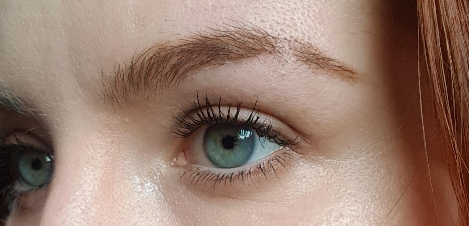 Татуаж бровей алопеция. Алопеция бровей у детей. Почему выпала бровь. Почему выпала бровь. Почему выпала бровь.