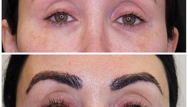 ویژگی‌های یک کلینیک کاشت ابرو